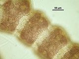 5 - Zone nodali con cellule secretrici